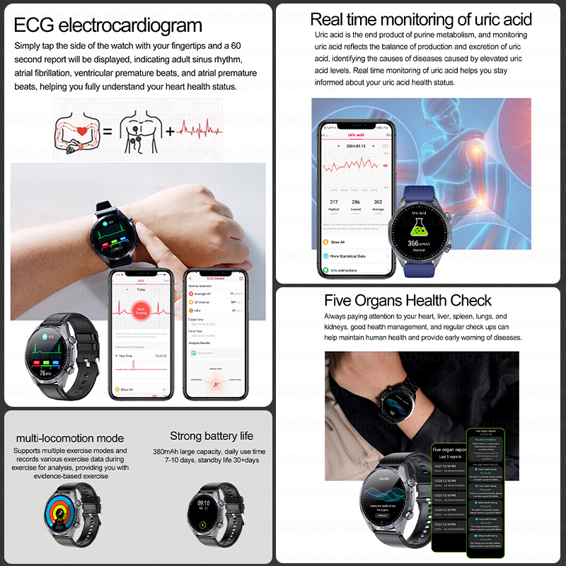 2026 Nowy Ulepszony Smartwatch – Smartwatch Watches Brands For Women recenzja i cena